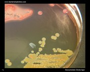 deoxycholate citrate agar lactose fermentation